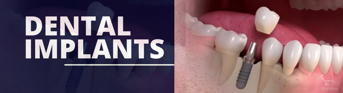 10 Undeniable Facts About tooth prosthesis