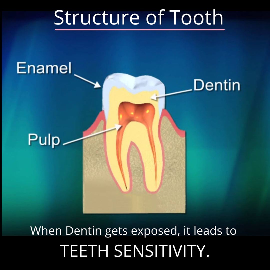 Teeth Sensitivity causes, treatments, and home remedies