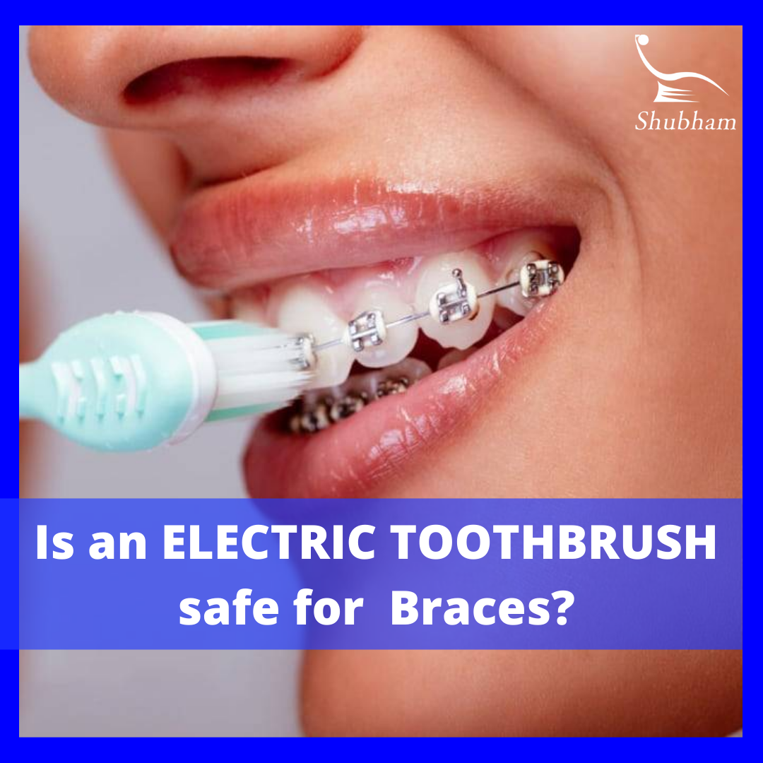 10 COMMONLY ASKED QUESTIONS ABOUT ELECTRIC TOOTHBRUSHES| ELECTRIC TOOTHBRUSHES| BEST DENTIST IN HISAR