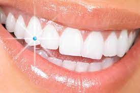Tooth Jewelry- Shubham Dental Clinic in Hisar