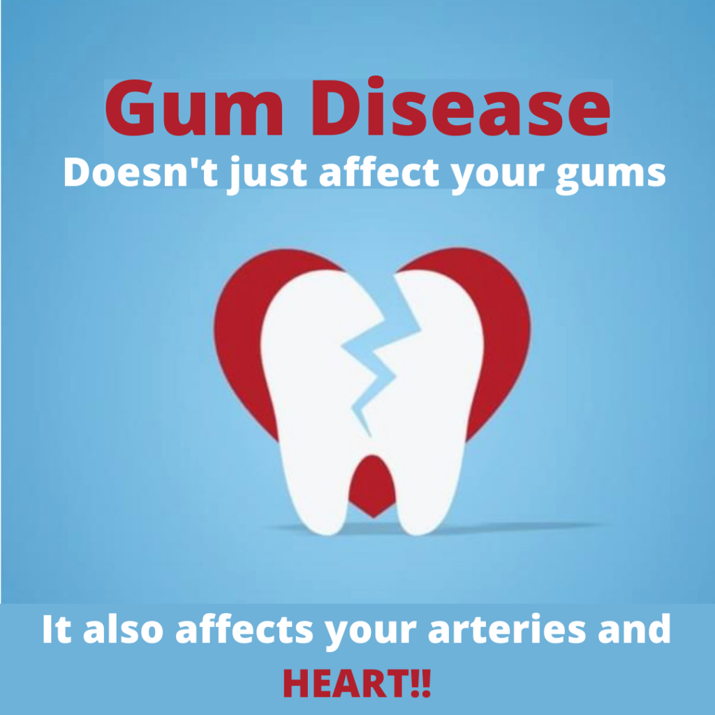 gum disease and heart health-periodontal disease and heart heath- Shubham dental clinic Hisar-best dental hospital in Hisar