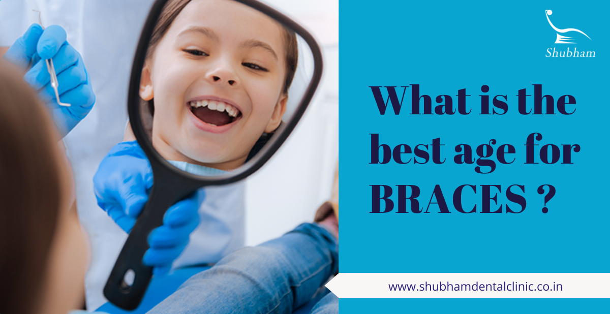 What is the best age for braces? Shubham Dental Clinic