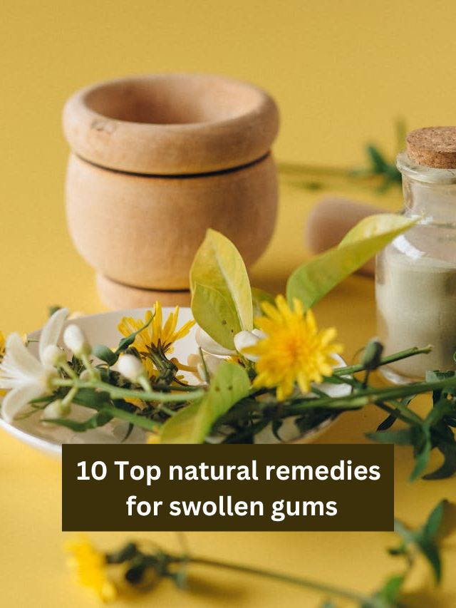 10 Top natural remedies for swollen gums