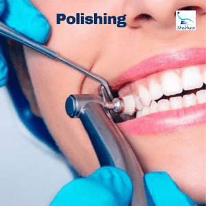 Teeth polishing |teeth whitening near me| best dentist in Hisar| dentist near me| Scaling and polishing |dental cleaning in Hisar| dental cleaning|