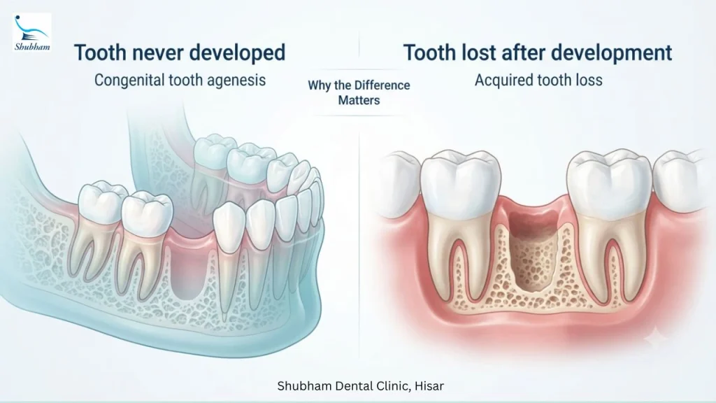 Comparison of congenital tooth agenesis, where a tooth never developed, and tooth loss after normal development